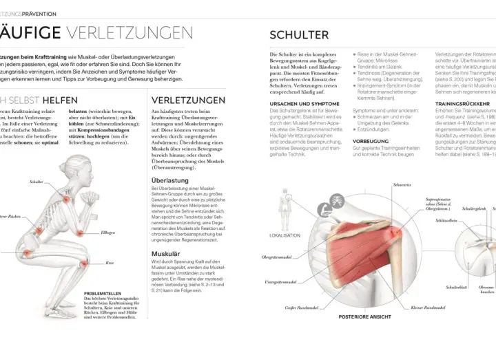 Schulterverletzungen beim Krafttraining: Was ist ein Satz im Gym? Überlastung, Risse und Entzündungen sind häufig. Vorbeugung durch gute Technik und Pausen.