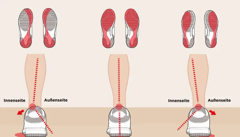 Illustrationen zeigen Pronation, Neutralstellung und Supination des Fußes. Die Pronation bedeutung wird durch die Abrollbewegung des Fußes auf der Innenseite erklärt.