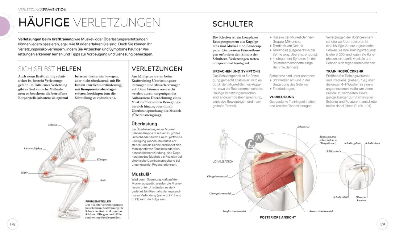 Schulterverletzungen beim Krafttraining: Was ist ein Satz im Gym? Überlastung, Risse und Entzündungen sind häufig. Vorbeugung durch gute Technik und Pausen.