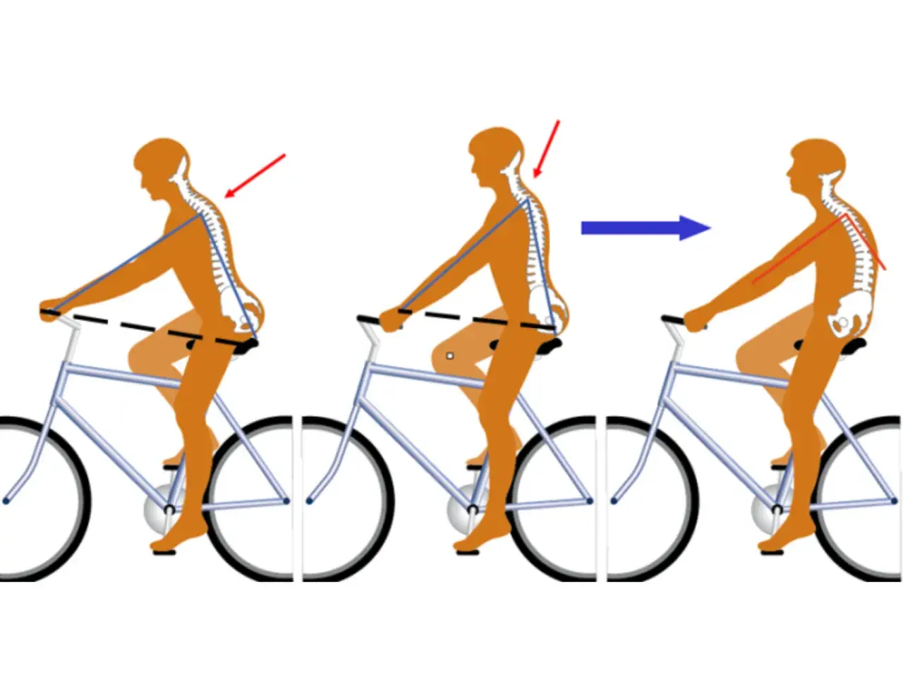 Optimale Haltung auf dem Fahrrad: Der richtige Abstand zwischen Sattel und Lenker für eine gesunde Wirbelsäule.